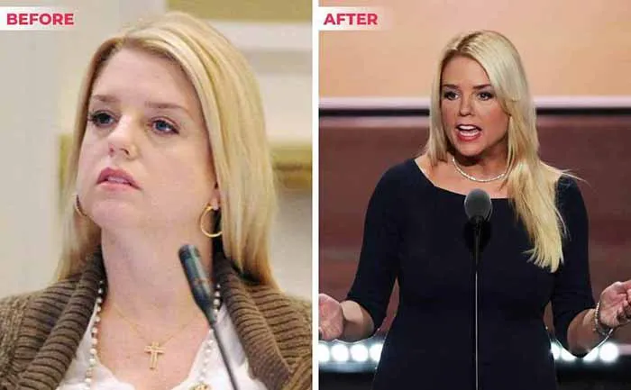Challenges-During-Pam-Bondi-Weight-Loss