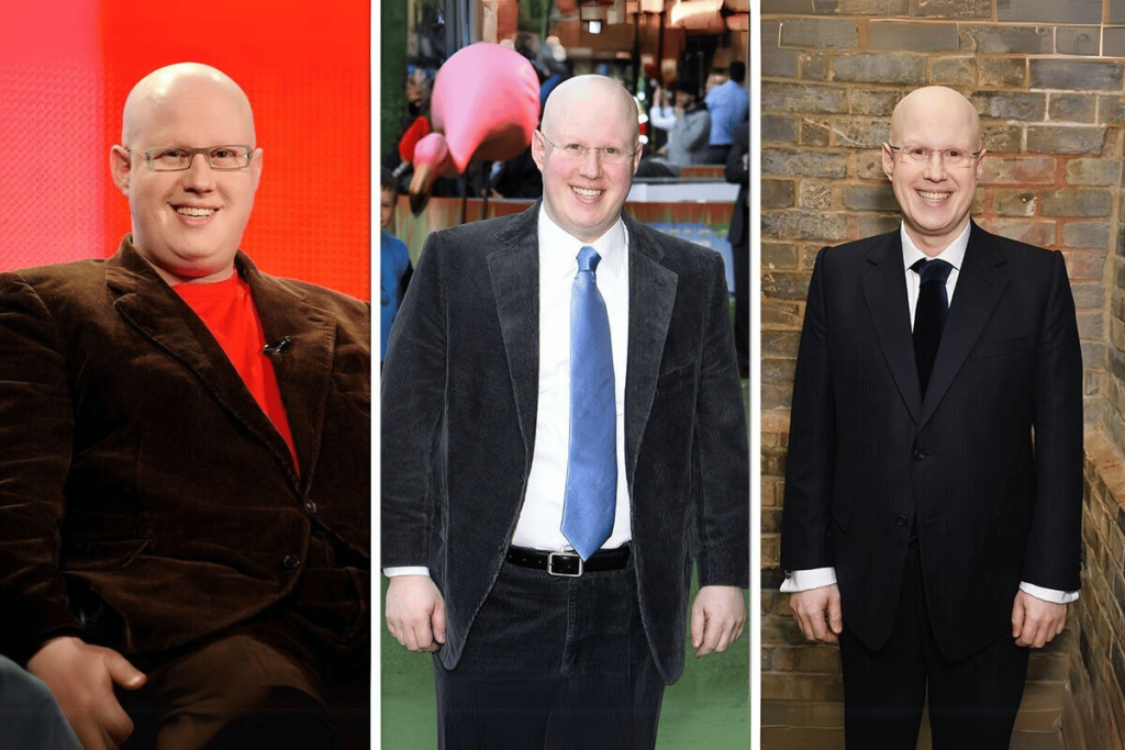 Did-Matt-Lucas-Have-Weight-Loss-Surgery